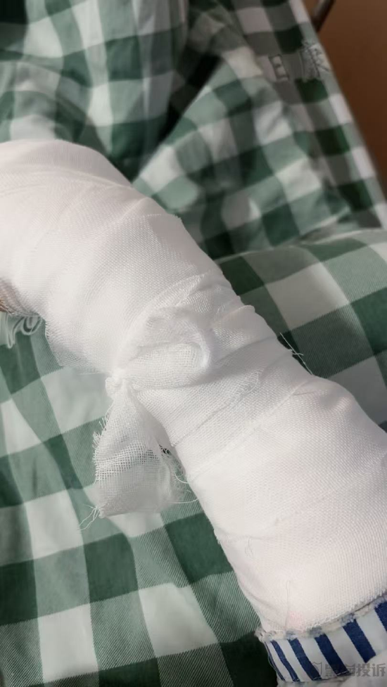 3月黑猫投诉酒店民宿领域红黑榜:维也纳酒店保洁留泡沫致客骨折 第3张 3月黑猫投诉酒店民宿领域红黑榜:维也纳酒店保洁留泡沫致客骨折 第3张